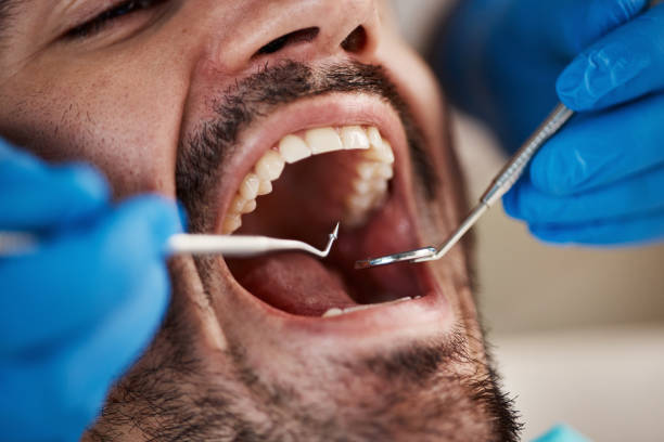 Best Emergency Dental Extractions in Goodrich, MI