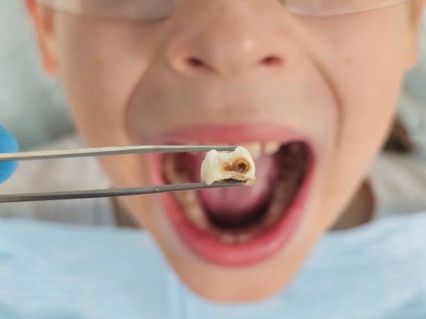 Best Emergency Root Canal Treatment in Goodrich, MI